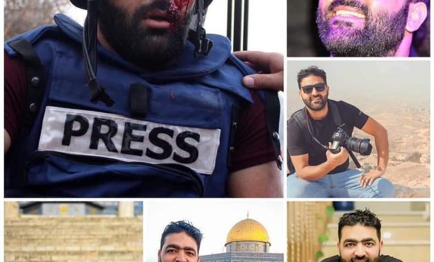 Mu’adz Amaranah,Jurnalis Palestina kehilangan mata kirinya karena tertembak serdadu Israel.